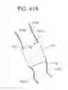 Fig. 103 - TISSUE AUGMENTATION TACKS FOR USE WITH SOFT TISSUE FIXATION REPAIR SYSTEMS AND METHODS