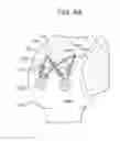 Fig. 13 - TISSUE AUGMENTATION TACKS FOR USE WITH SOFT TISSUE FIXATION REPAIR SYSTEMS AND METHODS