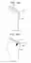 Fig. 26 - TISSUE AUGMENTATION TACKS FOR USE WITH SOFT TISSUE FIXATION REPAIR SYSTEMS AND METHODS