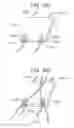 Fig. 65 - TISSUE AUGMENTATION TACKS FOR USE WITH SOFT TISSUE FIXATION REPAIR SYSTEMS AND METHODS