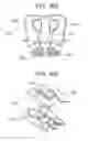 Fig. 94 - TISSUE AUGMENTATION TACKS FOR USE WITH SOFT TISSUE FIXATION REPAIR SYSTEMS AND METHODS