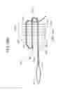 Fig. 95 - TISSUE AUGMENTATION TACKS FOR USE WITH SOFT TISSUE FIXATION REPAIR SYSTEMS AND METHODS