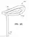 Fig. 05 - Off-center tissue anchors