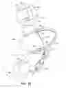 Fig. 19 - Off-center tissue anchors
