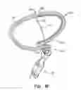 Fig. 20 - Off-center tissue anchors