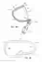 Fig. 22 - Off-center tissue anchors