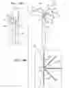 Fig. 23 - Off-center tissue anchors