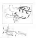 Fig. 28 - Off-center tissue anchors