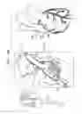 Fig. 30 - Off-center tissue anchors