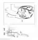 Fig. 32 - Off-center tissue anchors