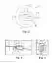 Fig. 03 - Adjustable suture restriction system and method