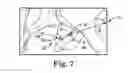 Fig. 06 - Adjustable suture restriction system and method