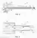 Fig. 03 - Systems and methods for percutaneous suture delivery