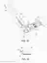 Fig. 10 - Systems and methods for percutaneous suture delivery