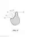 Fig. 03 - Apparatus and method of forming barbs on a suture