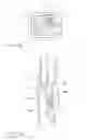 Fig. 04 - Apparatus and method for resectioning gastro-esophageal tissue