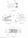 Fig. 09 - Apparatus and method for resectioning gastro-esophageal tissue