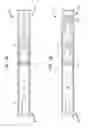 Fig. 05 - Clip applier with clip follower