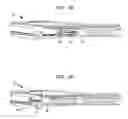 Fig. 13 - Clip applier with clip follower