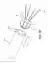 Fig. 49 - METHOD AND APPARATUS FOR RESTRICTING FLOW THROUGH AN OPENING IN THE SIDE WALL OF A BODY LUMEN, AND/OR FOR REINFORCING A WEAKNESS IN THE SIDE WALL OF A BODY LUMEN, WHILE STILL MAINTAINING SUBSTANTIALLY NORMAL FLOW THROUGH THE BODY LUMEN