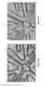 Fig. 69 - METHOD AND APPARATUS FOR RESTRICTING FLOW THROUGH AN OPENING IN THE SIDE WALL OF A BODY LUMEN, AND/OR FOR REINFORCING A WEAKNESS IN THE SIDE WALL OF A BODY LUMEN, WHILE STILL MAINTAINING SUBSTANTIALLY NORMAL FLOW THROUGH THE BODY LUMEN
