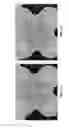 Fig. 76 - METHOD AND APPARATUS FOR RESTRICTING FLOW THROUGH AN OPENING IN THE SIDE WALL OF A BODY LUMEN, AND/OR FOR REINFORCING A WEAKNESS IN THE SIDE WALL OF A BODY LUMEN, WHILE STILL MAINTAINING SUBSTANTIALLY NORMAL FLOW THROUGH THE BODY LUMEN