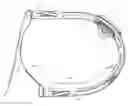 Fig. 01 - Radial compression band