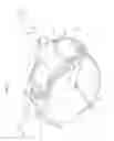 Fig. 02 - Radial compression band