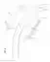 Fig. 10 - Radial compression band