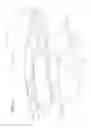 Fig. 12 - Radial compression band