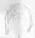 Fig. 19 - Radial compression band