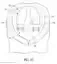 Fig. 12 - Tibial cut guide
