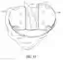 Fig. 13 - Tibial cut guide