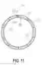 Fig. 11 - Medical device
