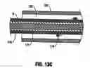 Fig. 14 - Atherectomy device