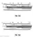 Fig. 17 - Atherectomy device