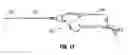 Fig. 18 - Atherectomy device