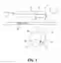 Fig. 02 - Ultrasound based method and apparatus for stone detection and to facilitate clearance thereof