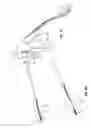 Fig. 02 - SURGICAL INSTRUMENTS FACILITATING REPLACEMENT OF DISPOSABLE COMPONENTS AND/OR STERILIZATION OF REUSABLE COMPONENTS