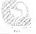 Fig. 02 - Minimally invasive implant and method