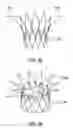 Fig. 23 - Prosthetic Valve System and Methods for Transluminal Delivery