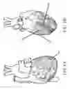 Fig. 07 - Devices and methods for controlling blood perfusion pressure along with regional mild hypothermia
