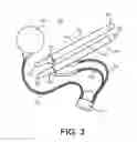 Fig. 04 - Inflatable penile prosthesis with reversible flow pump assembly