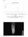 Fig. 04 - Parenteral bioactive substance delivery composition based on low molecular weight methyl cellulose