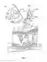 Fig. 02 - SYSTEMS, DEVICES, AND METHODS FOR SUBCUTANEOUS THERAPEUTIC TREATMENT