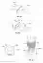 Fig. 06 - SYSTEMS, DEVICES, AND METHODS FOR SUBCUTANEOUS THERAPEUTIC TREATMENT
