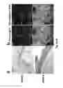 Fig. 11 - Acceleration of diabetic wound healing