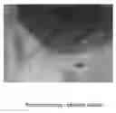 Fig. 01 - Compositions and methods for treating Crohn's disease and related conditions and infections