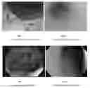 Fig. 02 - Compositions and methods for treating Crohn's disease and related conditions and infections