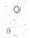 Fig. 02 - PUMPING SYSTEMS, ENDOLUMINAL DEVICES AND SYSTEMS FOR CREATING TWO-WAY BLOOD FLOW